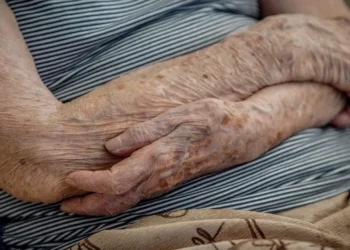 doença de Parkinson, tratamento, remédio;